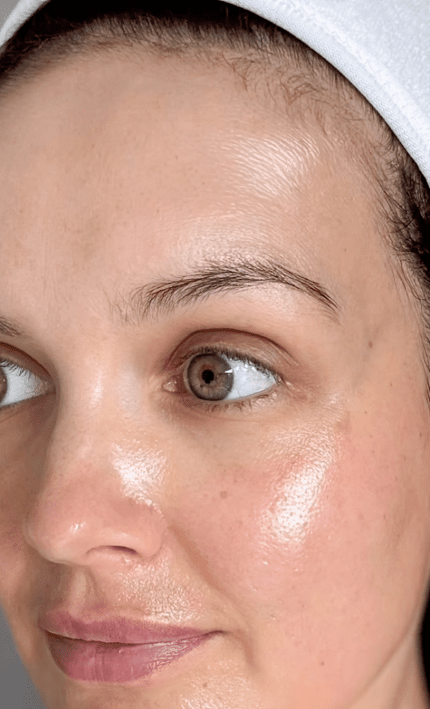 Vitamin C peel, IG @skincarebyjoanne | Treatwell