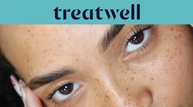 Treatwell teal banner with close-up of naturally lifted lashes after a Korean lash lift on freckled skin